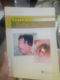 Image of cegah dini kanker dan tumor