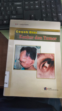 Image of Cegah Dini Kanker dan Tumor
